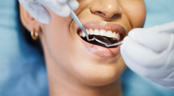 Best Knocked-Out Tooth (Avulsed Tooth) Treatment in Combe, LA